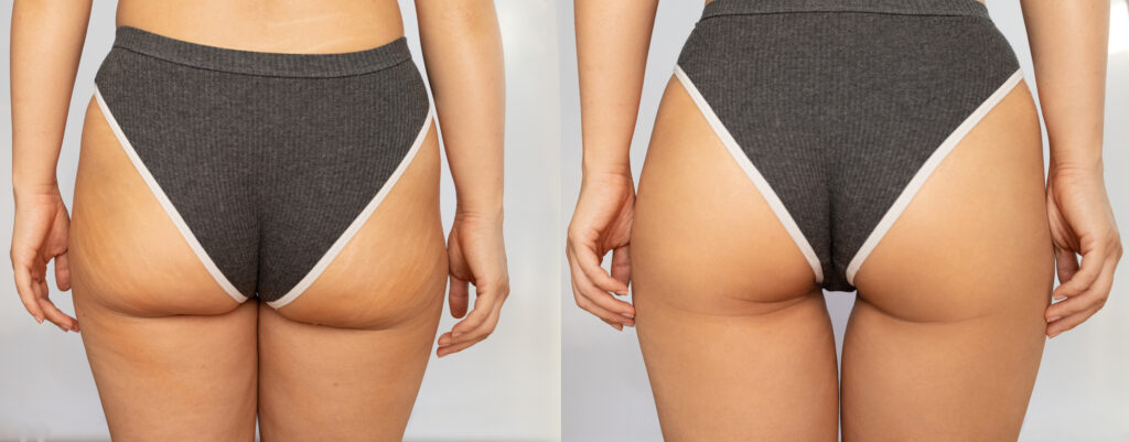 Patient results at SOMA Face and Body
